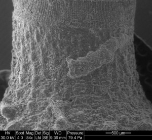 SpineForam1
